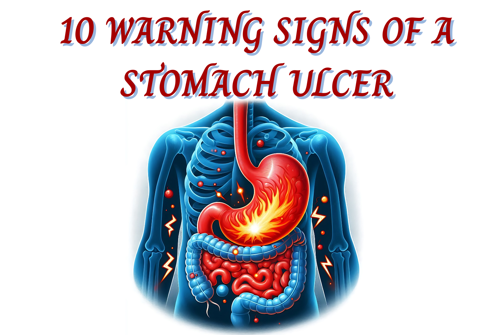 10 Warning Signs of a Stomach Ulcer