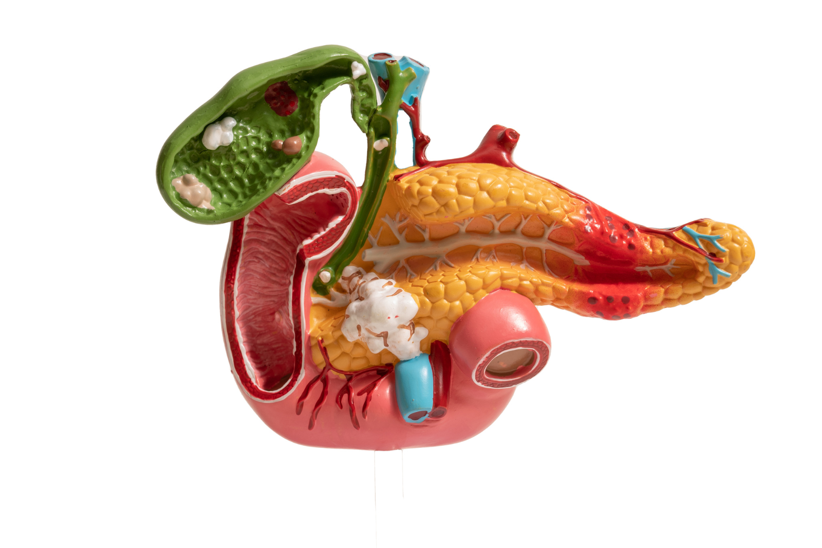 Pancreatitis: Causes, Symptoms and Expert Treatment in Hyderabad