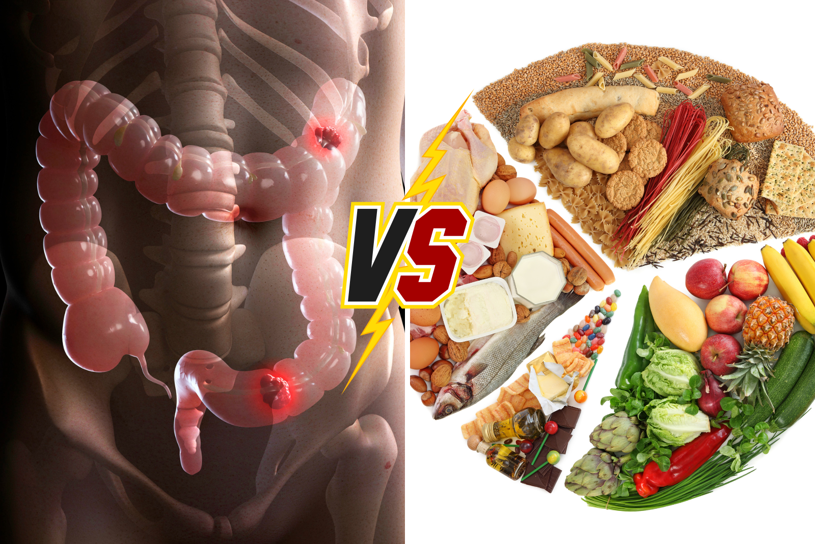 IBS or Food Sensitivity? Understanding the Difference and When to See a Doctor