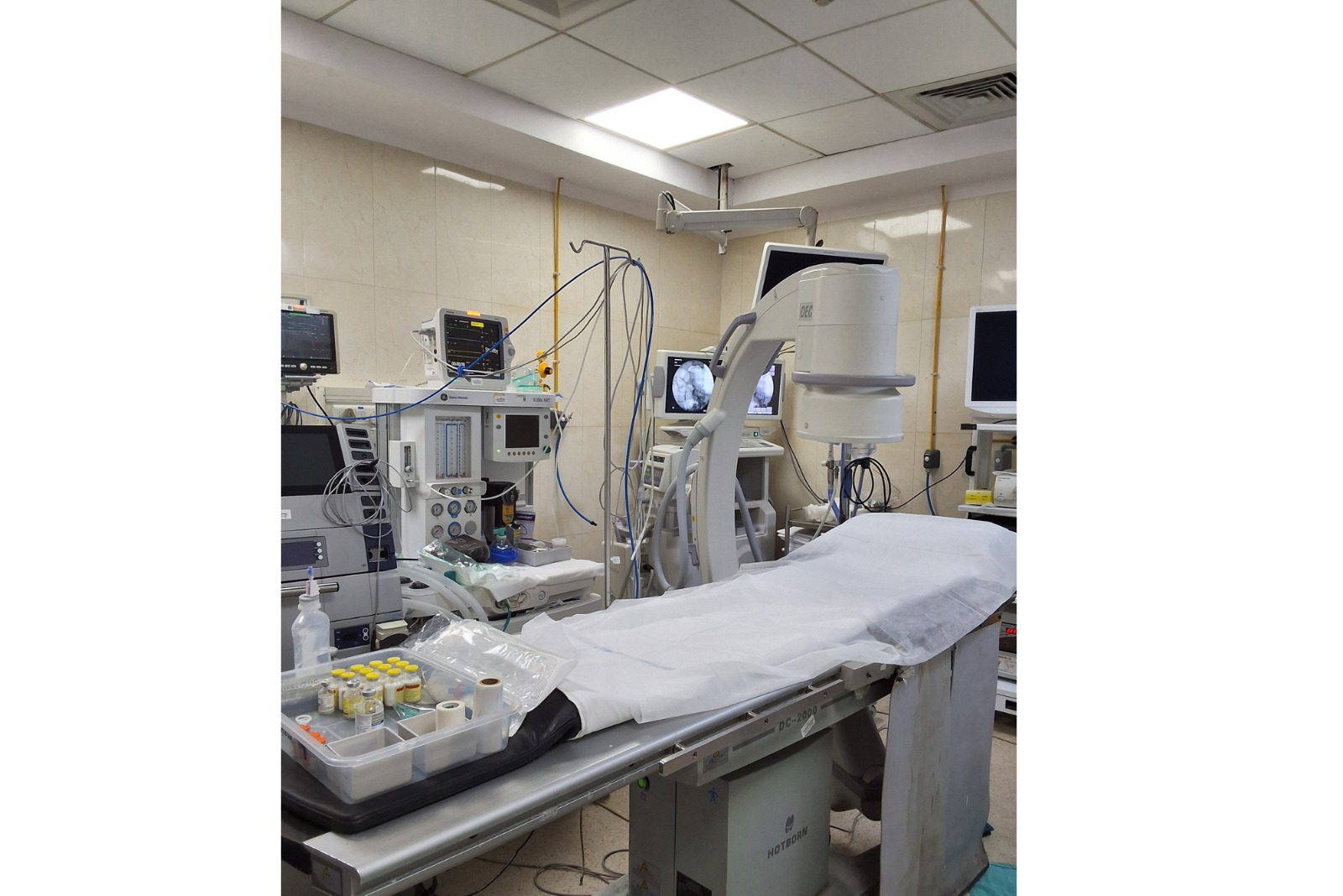 Modern Gastroenterology Treatments and Technology in Hyderabad